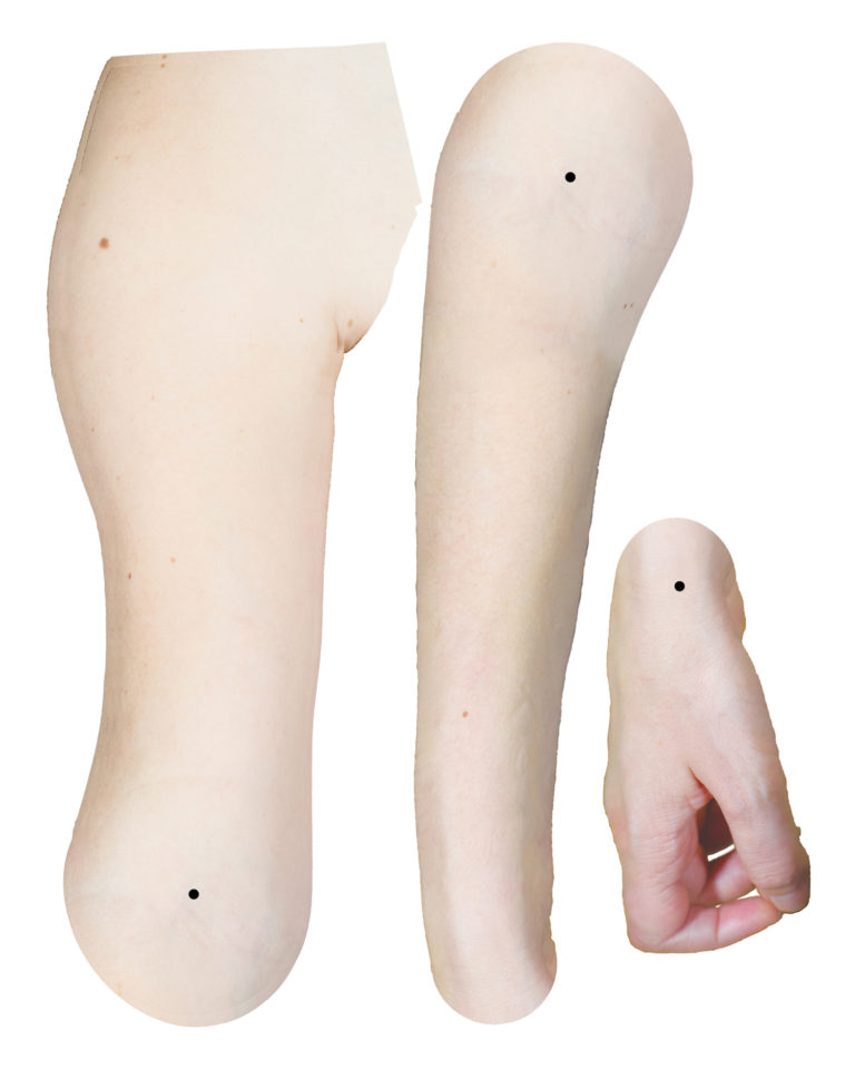 photograph of Yvette's arm from shoulder to elbow, elbow to wrist and her hand. They are printed in colour on a white background