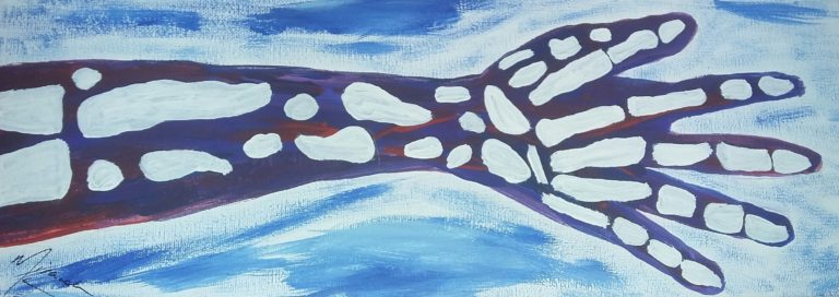 Painting of an arm with the bones showing. the image is blue and white with a little bit of red